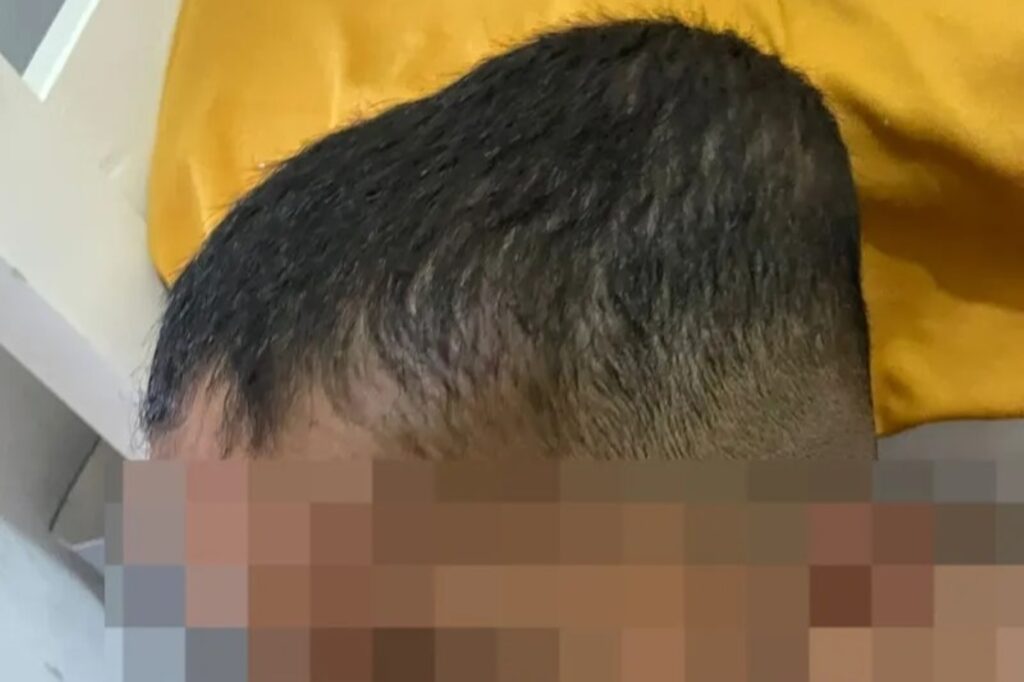 Babá de Criança Autista em Alagoas Denunciada por Agressões Babá de Criança Autista em Alagoas Denunciada por Agressões