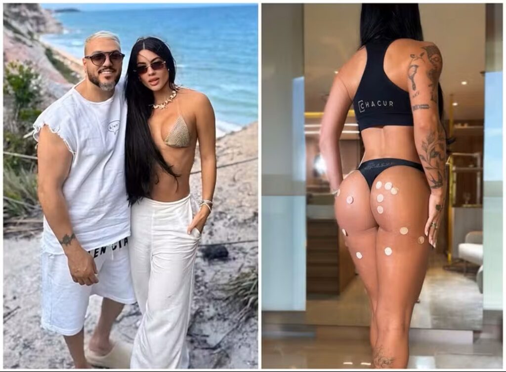 Namorada de Belo Revela Segredos do 'Bumbum Harmonizado' e Avisa: 'Flacidez Sempre Me Incomodou'