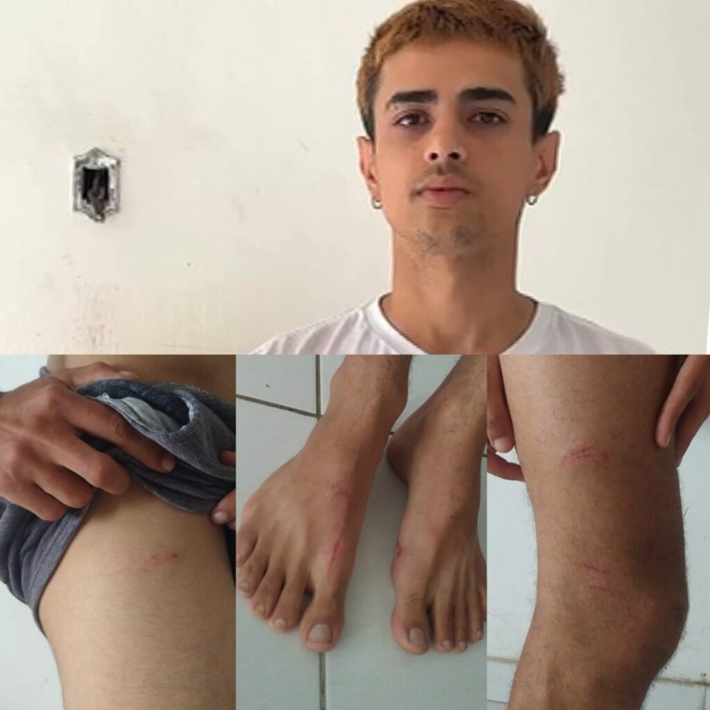 Entregador é Agredido em Maceió Após Ser Confundido com Assaltante