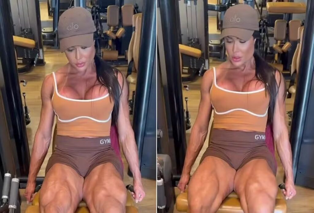 Gracyanne Treina de Short pela Primeira Vez Após Cirurgia: Uma Nova Fase na Reabilitação