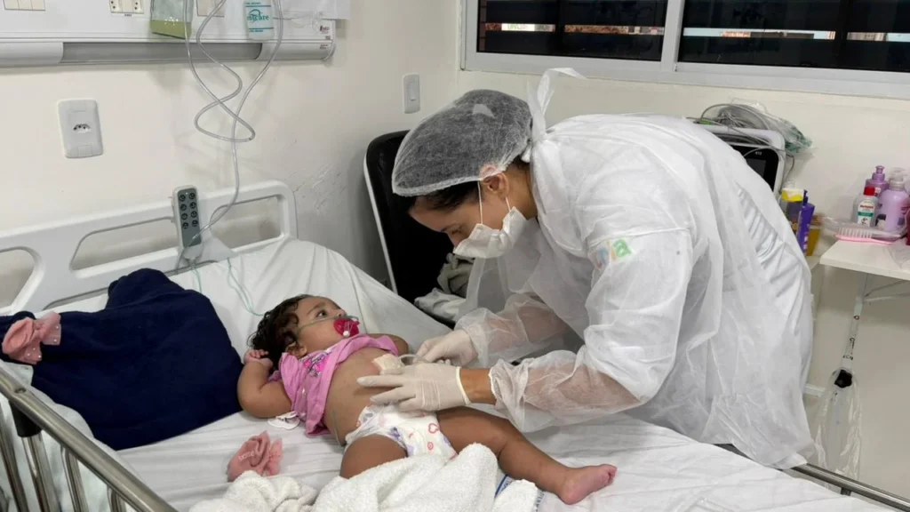 Queimaduras nas Festas Juninas: 5 Dicas Essenciais das Enfermeiras do Hospital da Criança de Alagoas